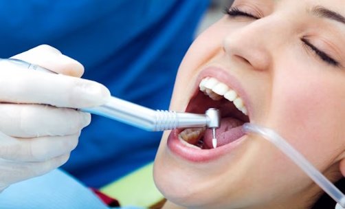 Periodoncia